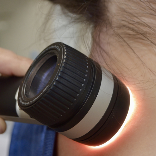 Hautcheck mit Auflichtmikroskopie